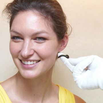 Patientin erhält eine Blutegeltherapie am Ohrläppchen